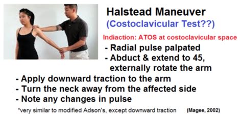 costoclavicular compression test|halstead test thoracic outlet.